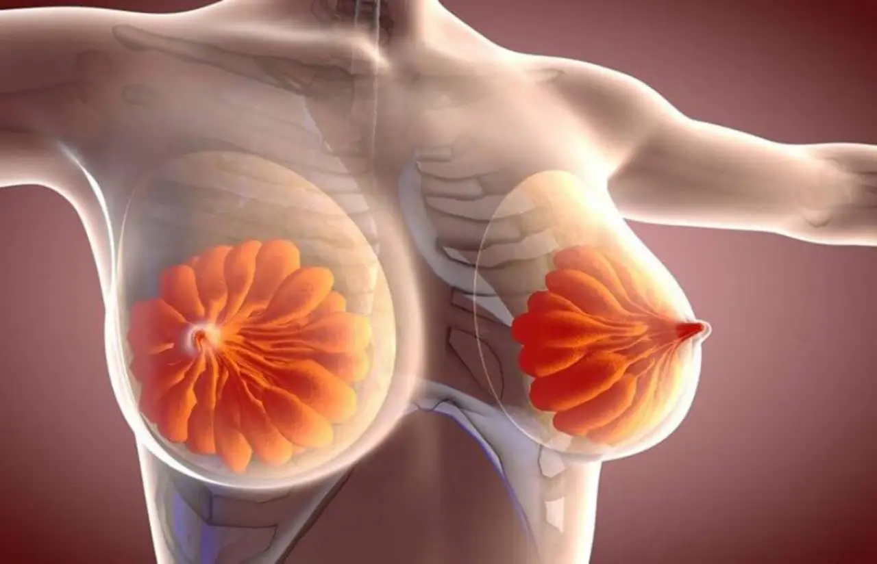 انواع روشهای بازسازی سینه پس از سرطان